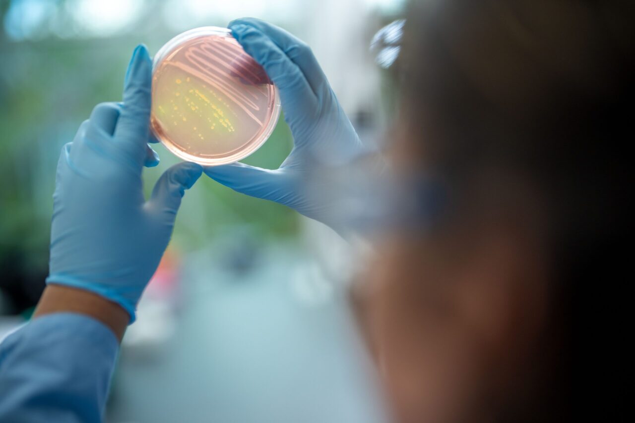 A person wearing blue nitrile gloves holds a circular petri dish containing a pink-orange agar medium with visible bacterial colonies up to natural light for visual inspection. The dish shows streaked colony growth patterns. The researcher's face is softly blurred in the foreground, and the background is an out-of-focus mix of greens and whites, suggesting a laboratory or clinical setting.